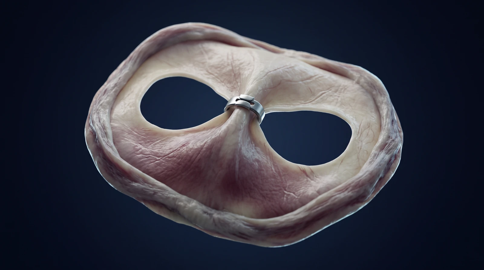 Representative medical illustration of central mitral leaflet approximation. AI-generated representative medical illustration; it does not depict a specific patient, device model or individual treatment plan.